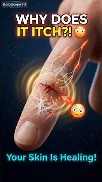 Why Do Healing Cuts Itch? 😳 The Surprising Science Inside Your Skin! #skin #skinhealing