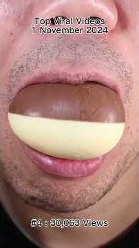 Satisfying Chewing ASMR #Compilation #ASMR #DoctorTristanPeh