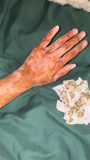 Effective Mefix Tape Removal for Henna Stains