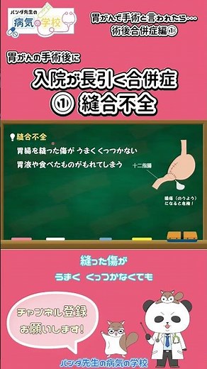 胃がんの手術後に入院が長引く合併症①縫合不全