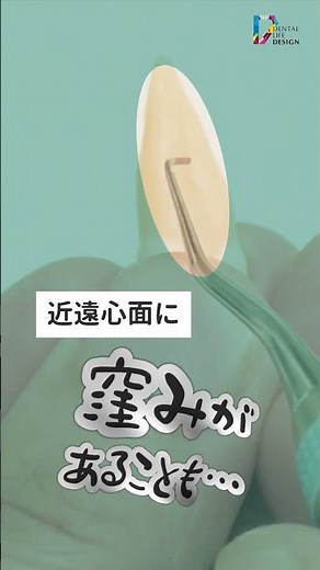 【SRPを行うための歯牙解剖について 上顎犬歯】今更聞けない歯科知識 新人歯科衛生士さんのためのお悩み相談室/萬田久美子先生 #shorts
