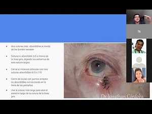 Lesiones malignas del párpado. Manejo Quirúrgico. Parte II