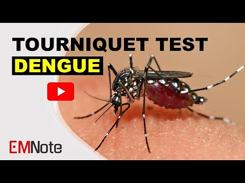 Dengue Fever and Tourniquet Test