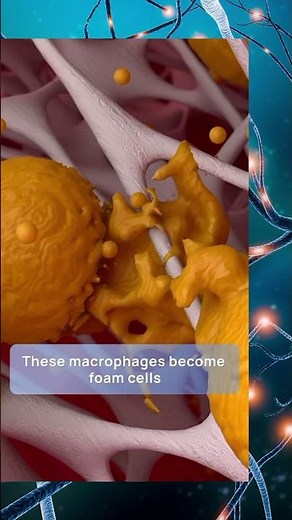 Atherosclerosis #3danimation