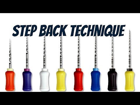 Endodontic Treatment (Step Back Technique)