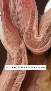 STOP ACID REFLUX FOR LIFE (Heartburn no more!)