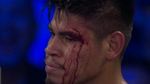 Navarrete retains title with technical decision over Suarez