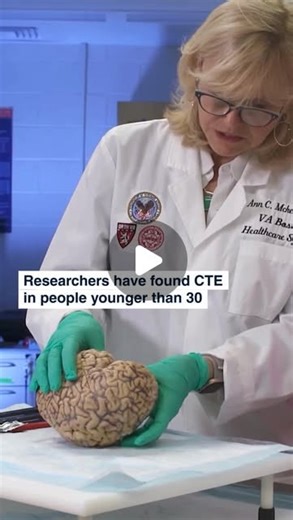 Concussion CTE Foundation | CTE isn’t just a problem for older, pro athletes. After examining the brains of 152 contact sport participants who had died under age 30,... | Instagram | Enrique TOPO Rodriguez