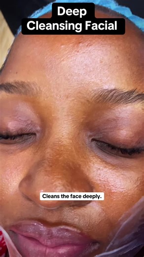 Our client just had a deep cleansing facial the foundation of every healthy skincare routine. This treatment removes impurities, unclogs pores, and balances oil production, leaving the skin fresh, smooth, and breathing again. Clean skin, confident glow. #deepcleansingfacial #skincareclinic #vitalityaesthetics #clearskinjourney #viral