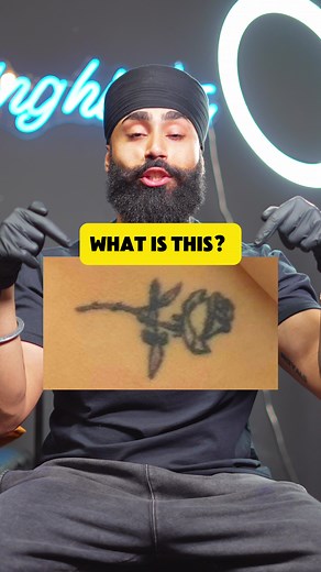 Tattoo Ink Blowout: Causes, Prevention & Management