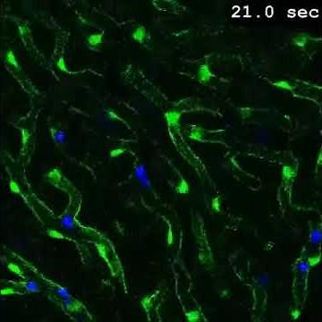 Real-time capture of RBCs by Kupffer cells.