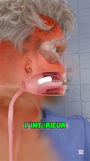 Comment Une Pilule Peut-Elle Résoudre La Constipation 🤔#shorts #viral