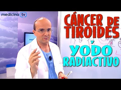 THYROID CANCER and RADIOACTIVE IODINE: What is it used for? - Cancer #41