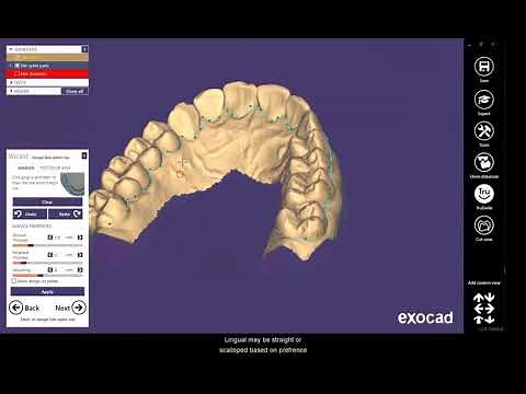 Design a bite splint for 3d printing in Exocad