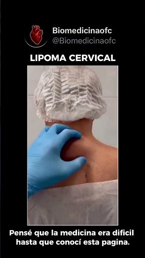 ⚠️ ¿TENÉS UN BULTITO EN EL CUELLO? LA CIENCIA DEL LIPOMA 🧬