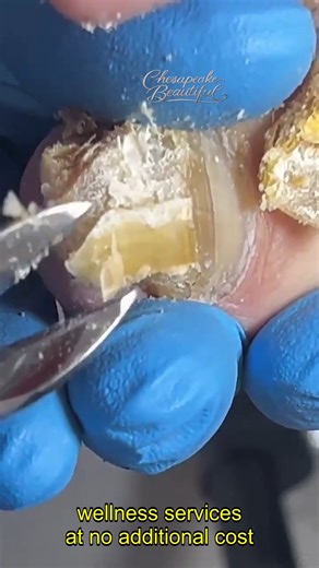 51K views · 230 reactions | Gentle Toe Exercises for Strength #ToeStrength #DailyHealth | Chesapeake Beautiful | Facebook