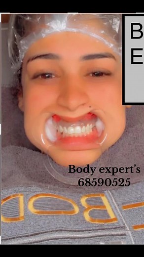 Body expert’s