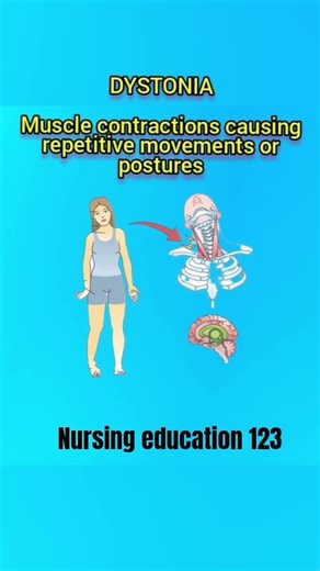 extra pyramidal symptoms