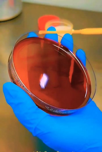 Microbiology is fun ❣️ 😁 #lablife #diagnosis #microbiology | Lab life