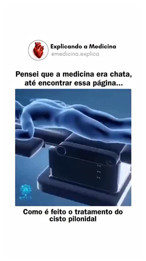 Explicando medicina | Saúde | Curiosidades on Instagram: "Como funciona o tratamento cirúrgico do cisto pilonidal? O cisto pilonidal é uma cavidade que se forma na região do cóccix e pode acumular pelos, secreções e causar infecções 🦠. A cirurgia remove o cisto e os tecidos inflamados ao redor, aliviando os sintomas, prevenindo infecções recorrentes e impedindo que ele volte a se formar ✅. A ferida pode ser fechada com pontos ou deixada aberta para cicatrizar naturalmente. Nos siga (@medicina.e