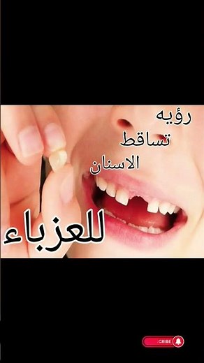 Interpretation of a dream about teeth falling out for a single woman #DreamInterpretation #BriefD...