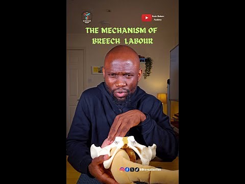 The Mechanism of Breech Labour - Breech Presentation [ Malpresentation]