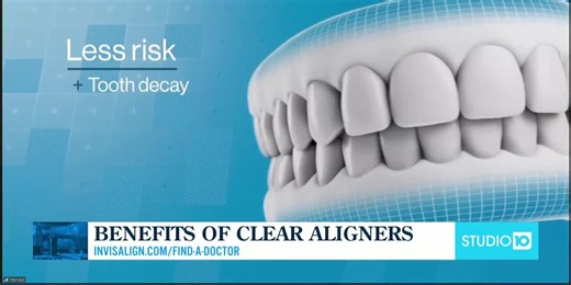 Metal Braces vs. Clear Aligners