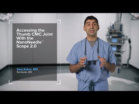 SpeedPearl: Accessing the Thumb CMC Joint With the NanoNeedle™ Scope 2.0