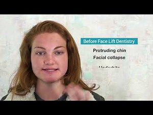 How To Fix a Protruding Chin Without Surgery