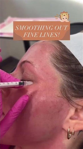 Smoothing Out Fine Lines