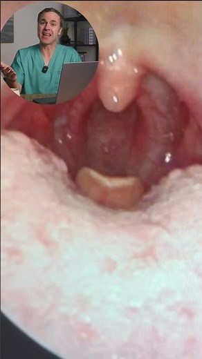 Pediatric Anatomy Insights: The "Thumb-Like" Epiglottis & Its Role in Intubation