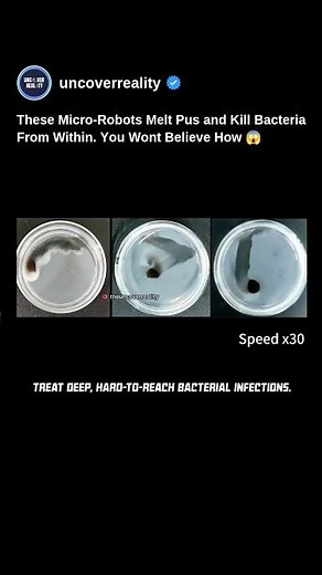 These Micro-Robots Melt Pus & Kill Bacteria From Within. You Won't Believe How 😱 #robot #shorts