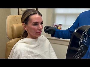Restore Facial Volume with Sculptra