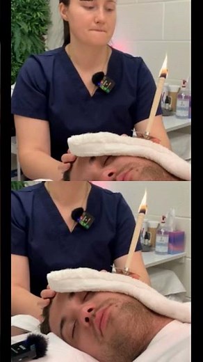 Ear Candling Benefits: Sleep, Sinus, & Lymphatics!