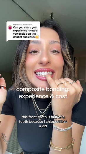 Composite Bonding: Experience & Cost