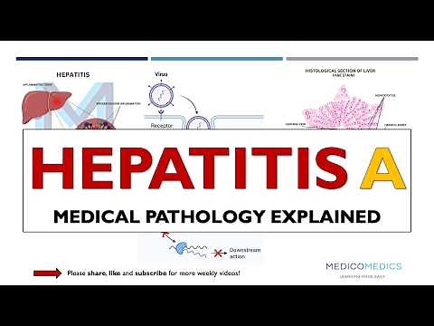 Hepatitis A | Transmission, Symptoms, Diagnosis, Treatment & Prevention