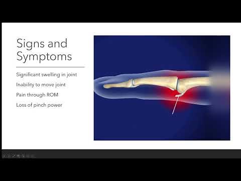 Volar Plate Avulsion: Tyler Schnitzler