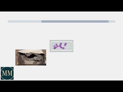 How to Remove Lint Trap Housing on Maytag Dryer – Lint Build-Up Cleanout Guide