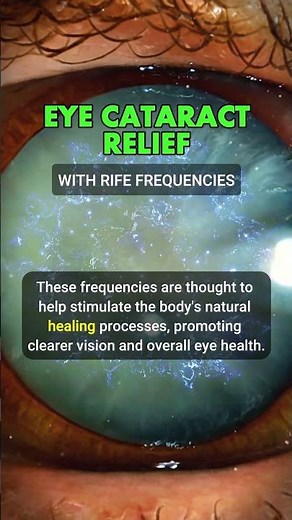 RIFE Frequencies for Eye CATARACT Relief