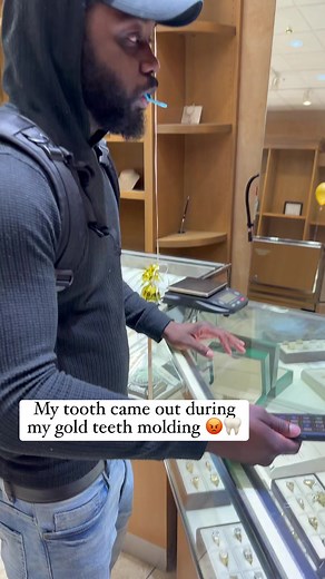 I went to the jeweler to get gold teeth and my tooth came out with the mold! Had to get an emergency dentist appointment 🤦🏾‍♂️😡🦷🦷 #reels #explore #explorepage #dentist #emergency #jewelry | MidrangeMartinez