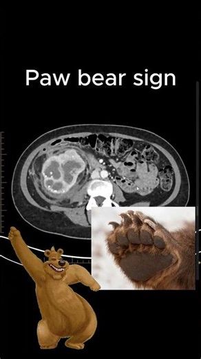 Paw Bear sign