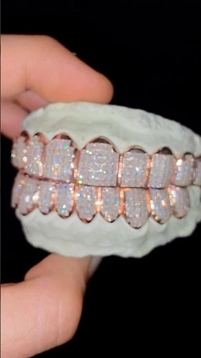 10 on 10 VVS Invisible Set Grillz in Moissanite