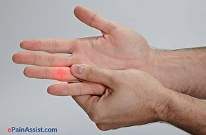 GINHAWA sa KAMAY ninyo. (Paki-SHARE po. LIBRE lahat ng TIPS namin.) Ehersisyo Para sa Daliri, Kamay: Masakit, Manhid, Trigger Finger at Carpal Tunnel Video ni Doc Willie Ong LIVE Gawin ang Ehersisyo sa Daliri at kamay. 1. Ibukas-sara ang kamay, itaas-baba din ng 30 segundo. 2. Baluktutin ang daliri ng 20 beses sa bawat JOINT nito. 3. I-masahe ang bawat daliri mula sa palad hanggang sa dulo ng daliri. 4. Sa trigger finger (lumalagutok na daliri), i-masahe ang ibaba ng daliri kung saan may maliit 