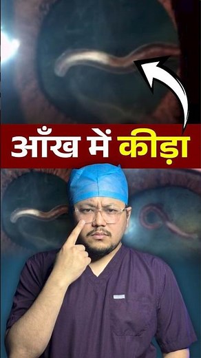 Live Worm Inside the Eye! 😳 (Rare Case Explained)
