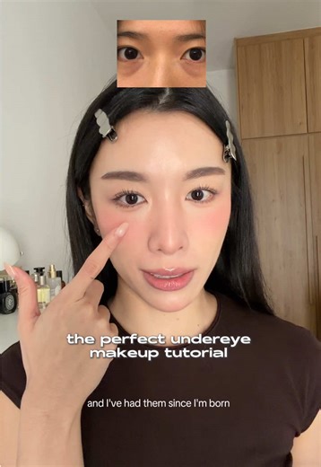 Effective Tear Trough Coverage Techniques