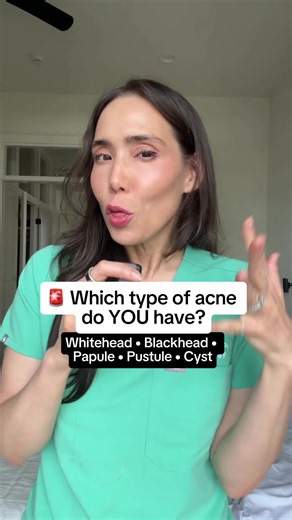 POV: You've been using what you thought were the best acne products and your acne still isn't getting better 😭 The problem might not be your products… it might be that you're treating the wrong type of acne. But you'll notice a recurring theme here: retinoids/adapalene are often a foundational part of acne treatment. - Whiteheads: The first two ingredients I usually think about are salicylic acid and retinoids/adapalene. Salicylic acid helps unclog pores, while retinoids help treat and prevent 