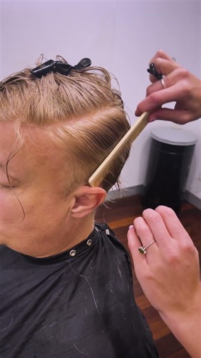 This is NOT a hair transplant.