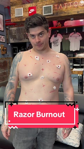 Razor Burnout #fyp #foryou #tattooartist #tattooskit #tattooist | tattoos