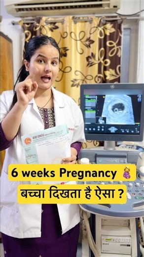 6 हफ़्ते की प्रेगनेंसी सोनोग्राफी में बच्चा कैसा दिखता है ? Pregnancy sonography #ytshorts