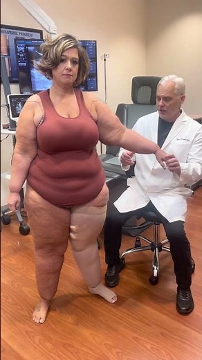 Dr Wright shows the signs of lipedema in the arms with a wrist cuff